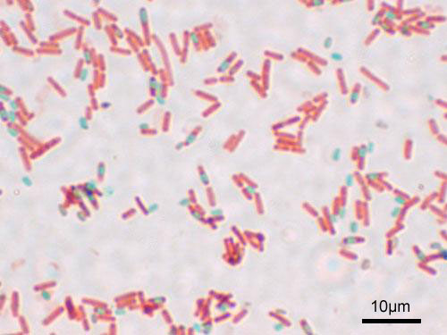Bacillus Subtilis Gram Stain